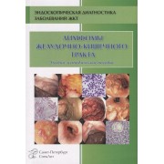 Лимфомы желудочно-кишечного тракта. Учебно-методическое пособие