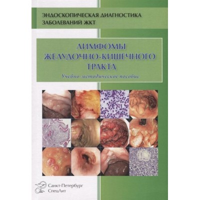 Лимфомы желудочно-кишечного тракта. Учебно-методическое пособие Лимфомы желудочно-кишечного тракта. Учебно-методическое пособие