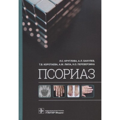 Псориаз Псориаз