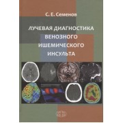 Лучевая диагностика венозного ишемического инсульта