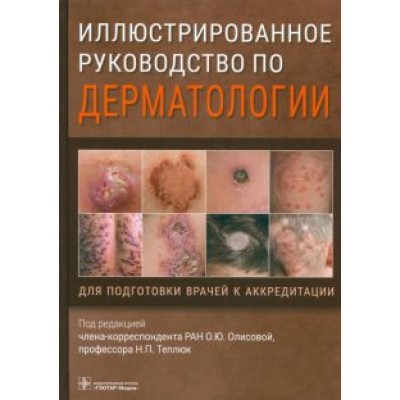 Олисова, Кочергин, Теплюк: Иллюстрированное руководство по дерматологии. Для подготовки врачей к аккредитации Олисова, Кочергин, Теплюк: Иллюстрированное руководство по дерматологии. Для подготовки врачей к аккредитации