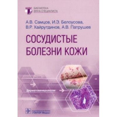 Самцов, Белоусова, Патрушев: Сосудистые болезни кожи. Руководство Самцов, Белоусова, Патрушев: Сосудистые болезни кожи. Руководство