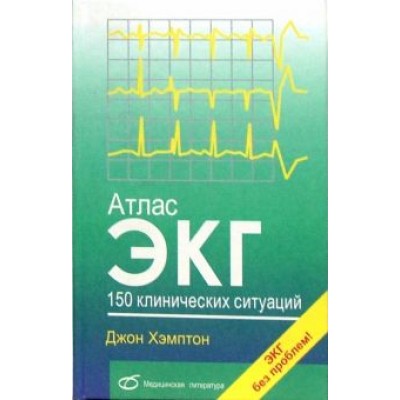 Джон Хэмптон: Атлас ЭКГ. 150 клинических ситуаций Джон Хэмптон: Атлас ЭКГ. 150 клинических ситуаций