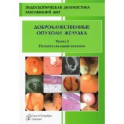 Добронец, Кузин, Шкалова: Доброкачественные опухоли желудка. Часть 2. Неэпителиальные опухоли
