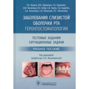Лукина, Абрамова, Ермакова: Заболевания слизистой оболочки рта. Геронтостоматология. Тестовые задания, ситуационные задачи