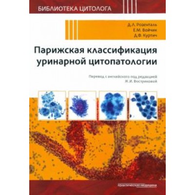 Розенталь, Войчик, Куртич: Парижская классификация уринарной цитопатологии Розенталь, Войчик, Куртич: Парижская классификация уринарной цитопатологии