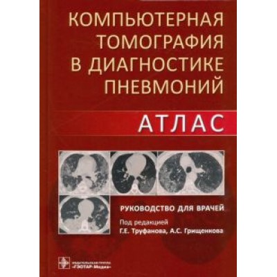 Геннадий Труфанов: Компьютерная томография в диагностике пневмоний. Атлас Геннадий Труфанов: Компьютерная томография в диагностике пневмоний. Атлас