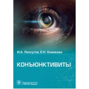 Лоскутов, Хомякова: Конъюктивиты