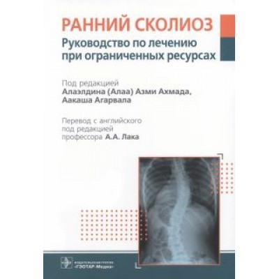 Ахмад, Агарвал, Абдельгавад: Ранний сколиоз. Руководство по лечению при ограниченных ресурсах Ахмад, Агарвал, Абдельгавад: Ранний сколиоз. Руководство по лечению при ограниченных ресурсах