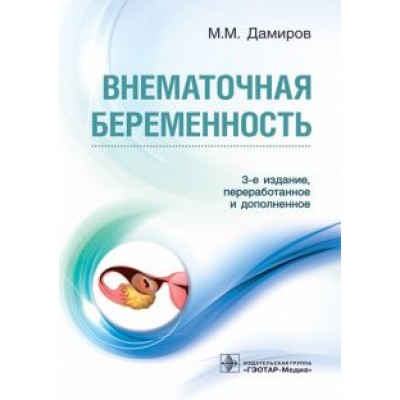 Михаил Дамиров: Внематочная беременность Михаил Дамиров: Внематочная беременность
