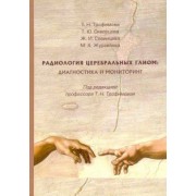 Трофимова, Скворцова, Савинцева: Радиология церебральных глиом. Диагностика и мониторинг