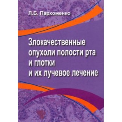 Лариса Пархоменко: Злокачественные опухоли полости рта и глотки и их лучевое лечение Лариса Пархоменко: Злокачественные опухоли полости рта и глотки и их лучевое лечение