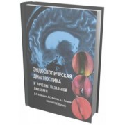 Потапов, Лопатин, Капитанов: Эндоскопическая диагностика и лечение назальной ликвореи