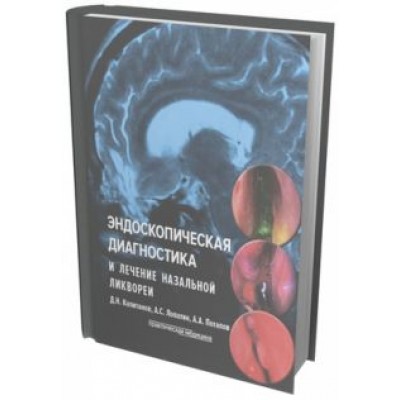 Потапов, Лопатин, Капитанов: Эндоскопическая диагностика и лечение назальной ликвореи Потапов, Лопатин, Капитанов: Эндоскопическая диагностика и лечение назальной ликвореи