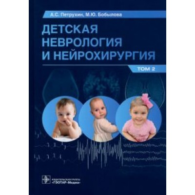Петрухин, Бобылова: Детская неврология и нейрохирургия. Учебник в 2 томах. Том 2 Петрухин, Бобылова: Детская неврология и нейрохирургия. Учебник в 2 томах. Том 2