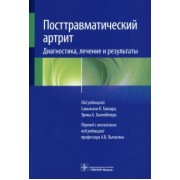 Посттравматический артрит. Диагностика, лечение и результаты