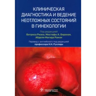 Абузейд, Абузейд, Адмон: Клиническая диагностика и ведение неотложных состояний в гинекологии Абузейд, Абузейд, Адмон: Клиническая диагностика и ведение неотложных состояний в гинекологии