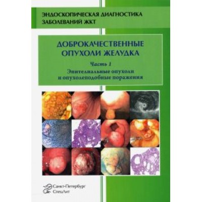 Кузин, Радовский, Добронец: Доброкачественные опухоли и опухолеподобные поражения желудка. Часть 1. Эпителиальные опухоли Кузин, Радовский, Добронец: Доброкачественные опухоли и опухолеподобные поражения желудка. Часть 1. Эпителиальные опухоли