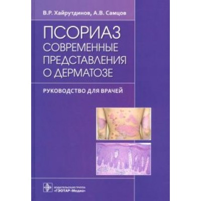 Самцов, Хайрутдинов: Псориаз. Современные представления о дерматозе. Руководство для врачей Самцов, Хайрутдинов: Псориаз. Современные представления о дерматозе. Руководство для врачей