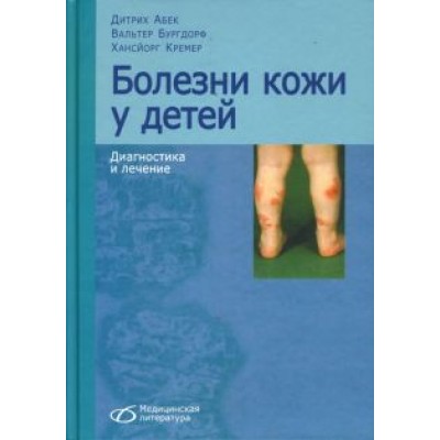 Абек, Бургдорф, Кремер: Болезни кожи у детей. Диагностика и лечение Абек, Бургдорф, Кремер: Болезни кожи у детей. Диагностика и лечение