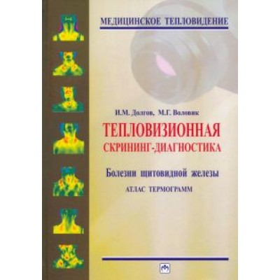 Долгов, Воловик: Тепловизионная скрининг-диагностика. Болезни щитовидной железы. Атлас термограмм Долгов, Воловик: Тепловизионная скрининг-диагностика. Болезни щитовидной железы. Атлас термограмм