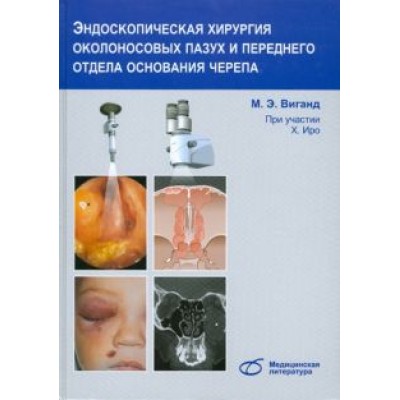 Виганд, Иро: Эндоскопическая хирургия околоносовых пазух и переднего отдела основания черепа Виганд, Иро: Эндоскопическая хирургия околоносовых пазух и переднего отдела основания черепа