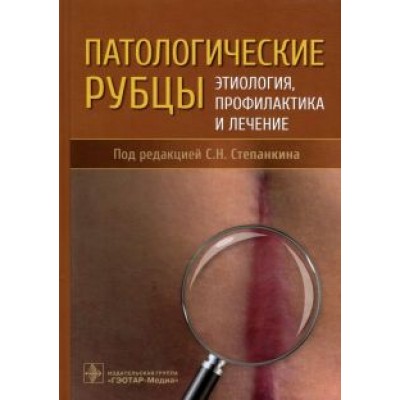 Степанкин, Ахтямов, Горфинкель: Патологические рубцы. Этиология, профилактика и лечение Степанкин, Ахтямов, Горфинкель: Патологические рубцы. Этиология, профилактика и лечение