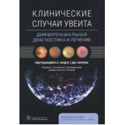 Клинические случаи увеита. Дифференциальная диагностика и лечение