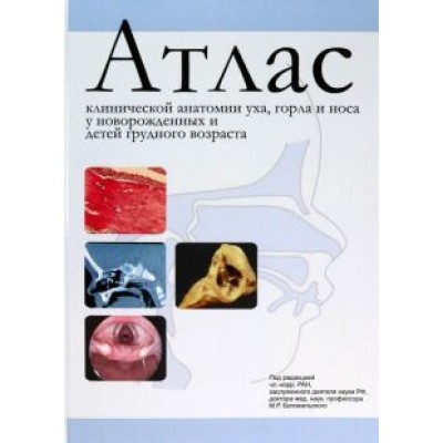 Рахманова, Котов, Баранов: Атлас клинической анатомии уха, горла и носа у новорожденных и детей грудного возраста Рахманова, Котов, Баранов: Атлас клинической анатомии уха, горла и носа у новорожденных и детей грудного возраста