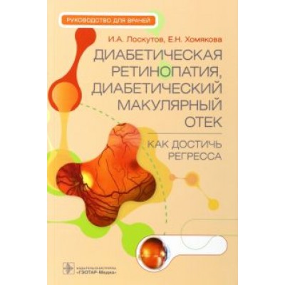 Лоскутов, Хомякова: Диабетическая ретинопатия, диабетический макулярный отек - как достичь регресса. Руководство Лоскутов, Хомякова: Диабетическая ретинопатия, диабетический макулярный отек - как достичь регресса. Руководство