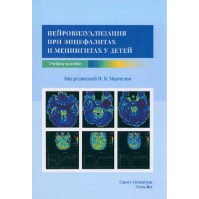 Марченко, Скрипченко, Алиев: Нейровизуализация при энцефалитах и менингитах у детей. Учебное пособие Марченко, Скрипченко, Алиев: Нейровизуализация при энцефалитах и менингитах у детей. Учебное пособие